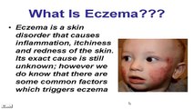 Susan Clark Eczema-Does Beat Eczema Guide Really Work?