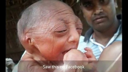 Indian Woman Gave Birth to Miracle Baby Looks 105 Years Old