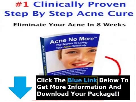 Mike Walden Acne No More Secrets plus Acne No More Book Online