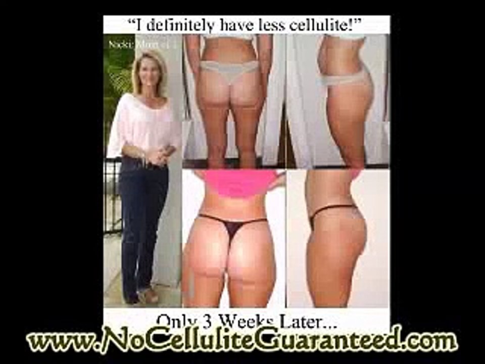 The Natural Way to Be Cellulite Free in Only 4 Weeks