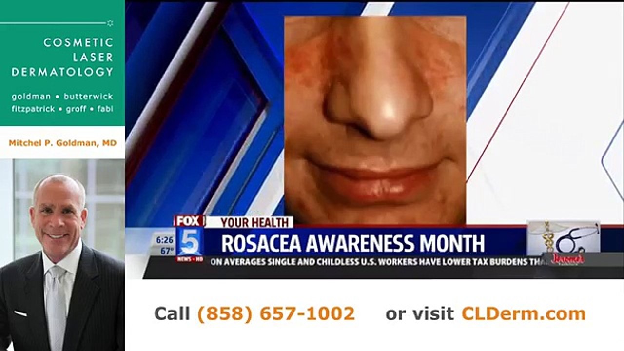 Rosacea Awareness | Expert San Diego Dermatologist Dr. Goldman