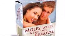 Moles Warts Skin Tags Removal Reviews-Does It Really Work?