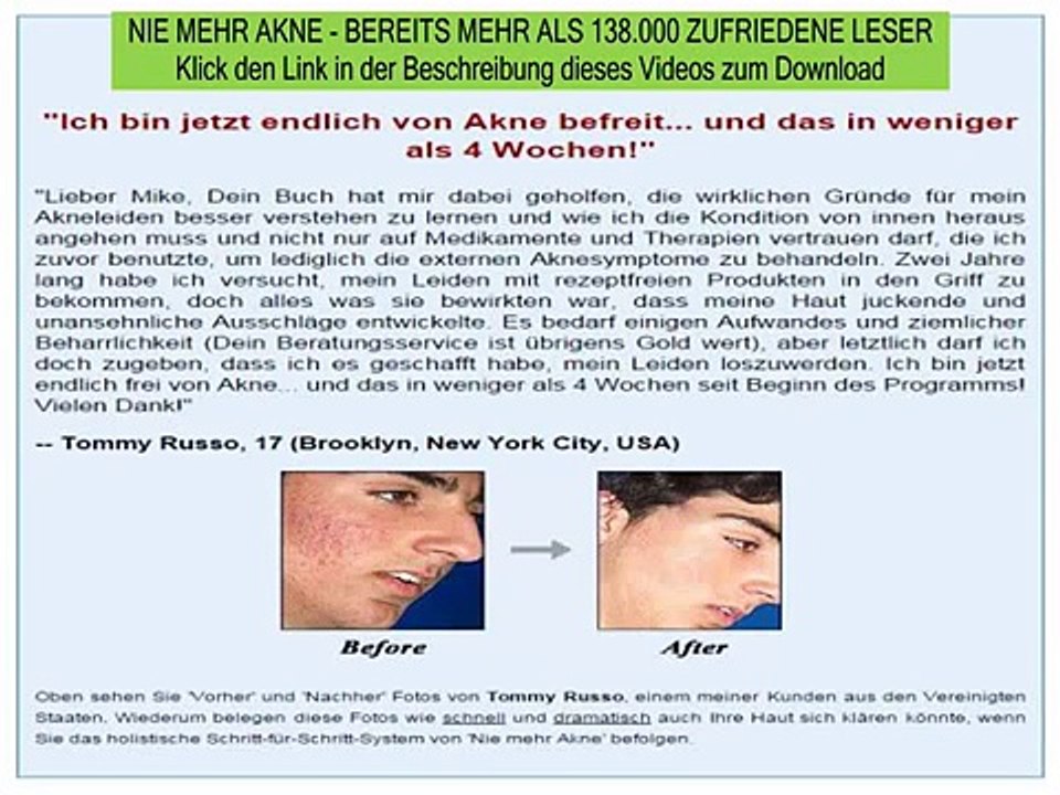 akne schnell heilen - akne von innen bekämpfen - nie mehr akne buch kostenlos
