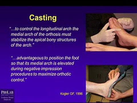 Plantar Fasciitis Orthotic Therapy