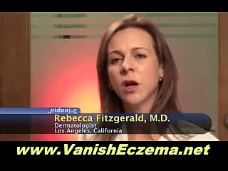 Eczema Free Forever: How To Beat Eczema