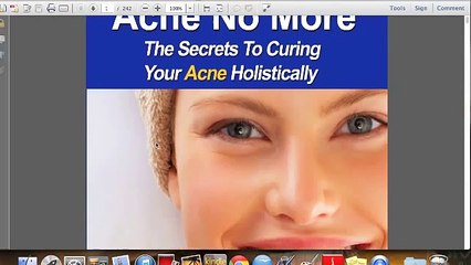 Mike Walden Acne No More Review Video