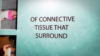 Cellulite Disappear Review