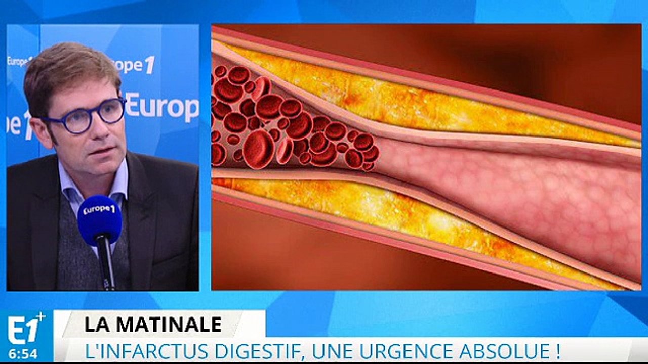 L'infarctus digestif : une urgence absolue