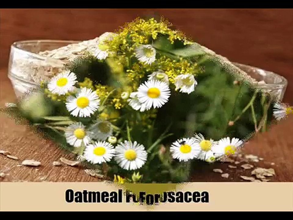8 Herbal Remedies to Eliminate Rosacea