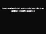 [Téléchargement PDF] Fractures of the Pelvis and Acetabulum: Principles and Methods of Management