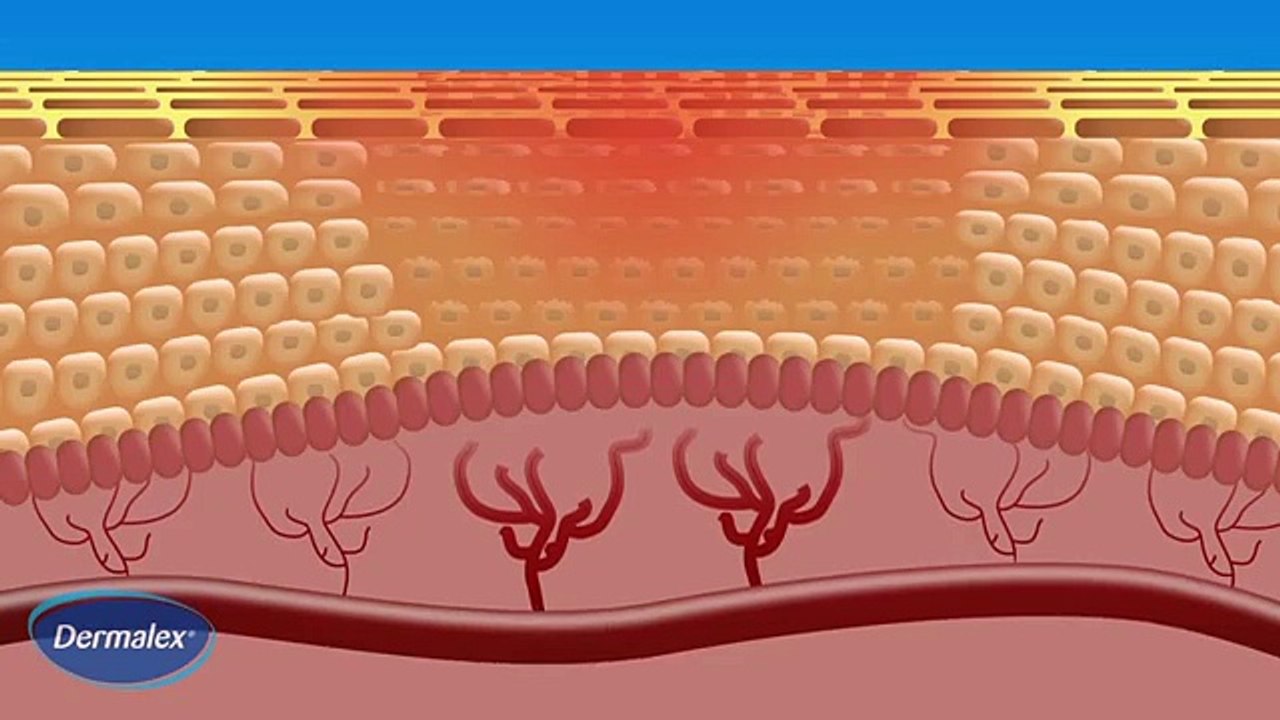 Dermalex Rosacea - How it works
