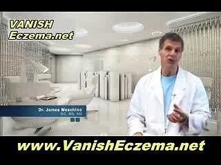 Eczema Free Forever Review - Should You Buy It?