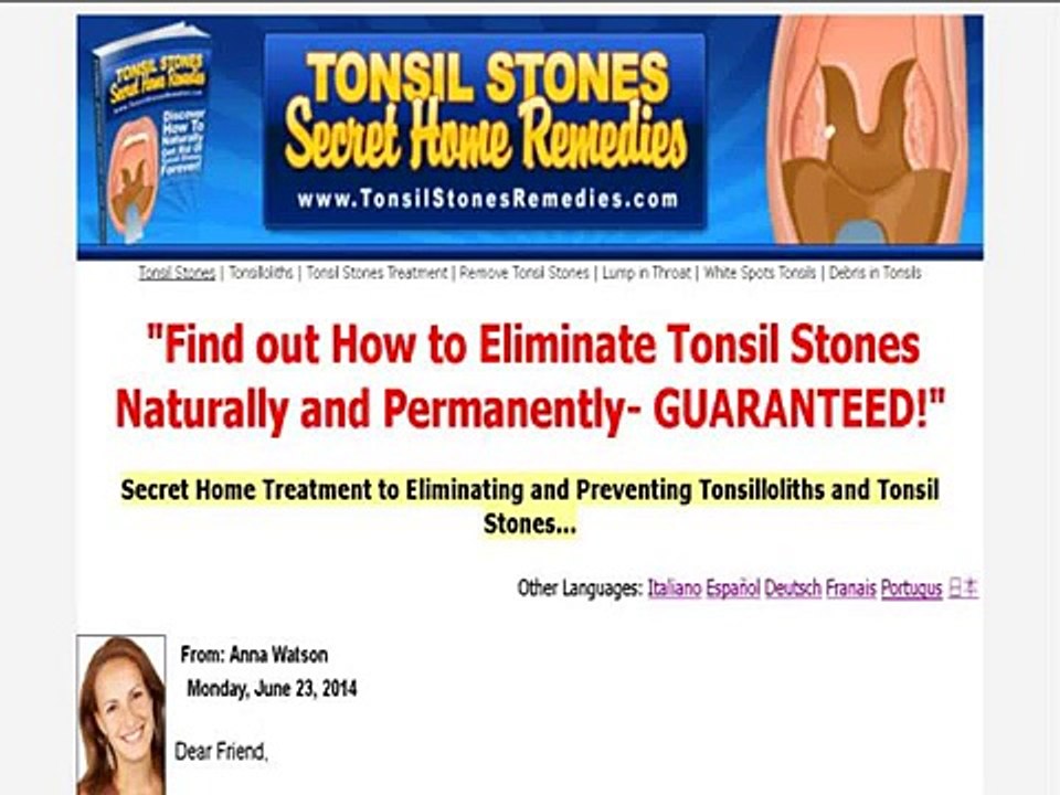 "Tonsil Stones Secret Home Remedies"