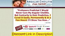 Angular Cheilitis Free Forever Discount, Coupon Code, Get $10 Off, Only $27