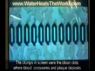 Alkaline Diet and Anti-Aging Part 3