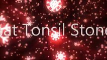 Tonsil Stones Cure Tonsil Stones Treatment