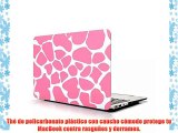 Carcasa para MacBook Air 11Funda Carcasa de Protector de para Apple MacBook Air 11 pulgadas