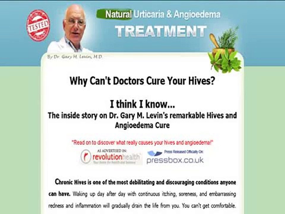 Find a Full Urticaria Cure By Dr Gary M.d | Con...