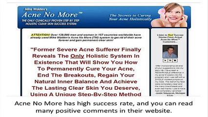 Acne No More Review (unbiased) | Testimonial from my friend Bobby