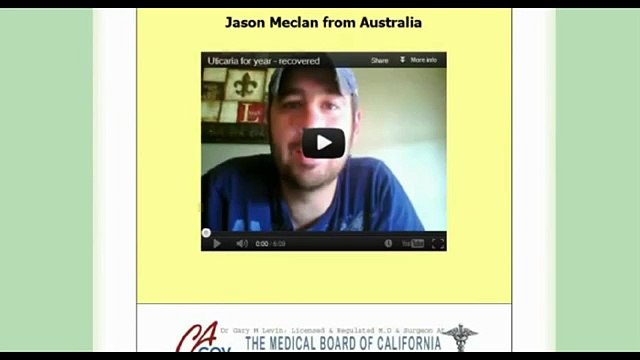 Full Urticaria Cure Reviews-Is it Scam or Does it Work?