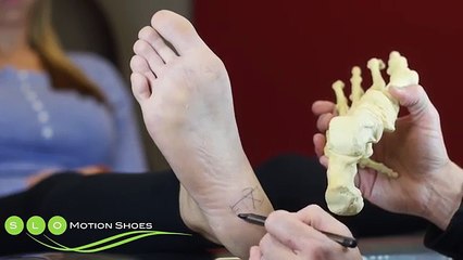 Plantar Fasciitis: Causes, Diagnosis, and Treatment