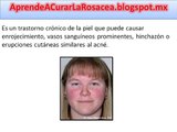 Causas De La Rosacea / Sintomas y Causas