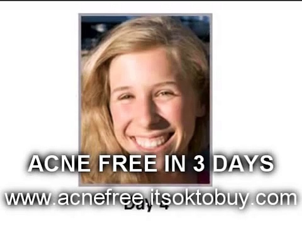 Acne Free In 3 Days, Is a Scam? (Acne Cure Really Works)