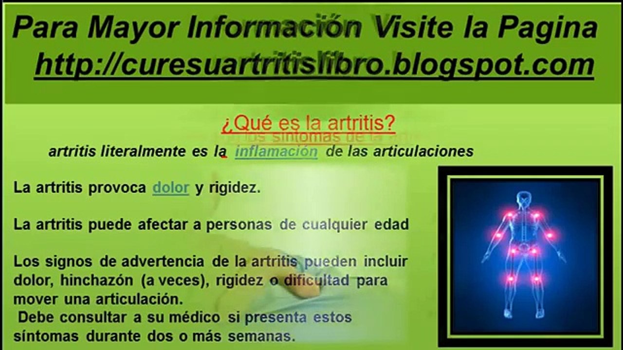 Artritis Sintomas |  cure su artritis
