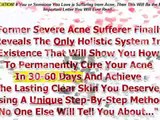 Acne No More (tm): Top Acne Book On Cb- *$27-$35/sale* Up To $45/sale!