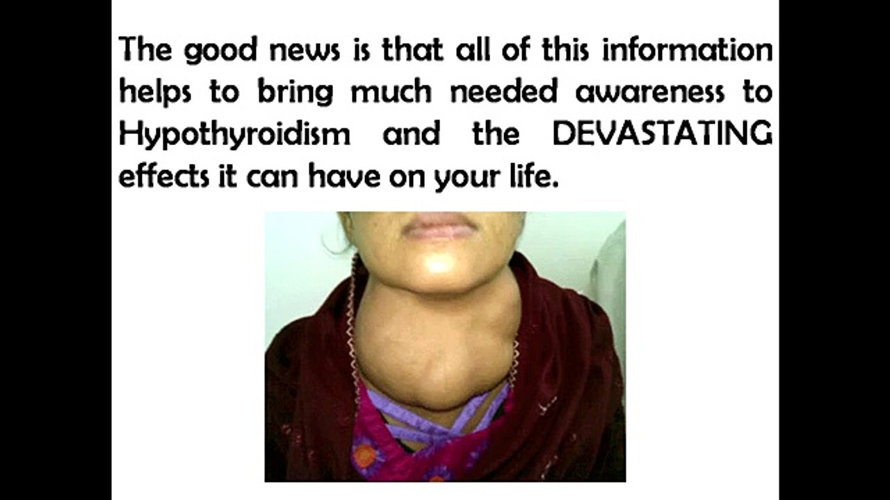 The Hypothyroidism Revolution Diet Plan | Best Diet For Hypothyroidism