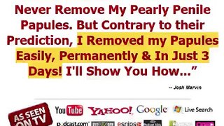 Pearly Penile Papules | Pearly Penile Papules Removal, Does It Work ?
