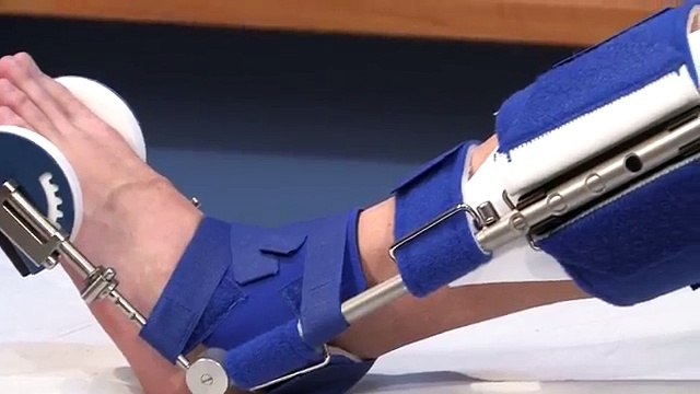 Dr. Stephen V Perns: Plantar Fasciitis & Achilles Tendonitis- A Dynasplint Review