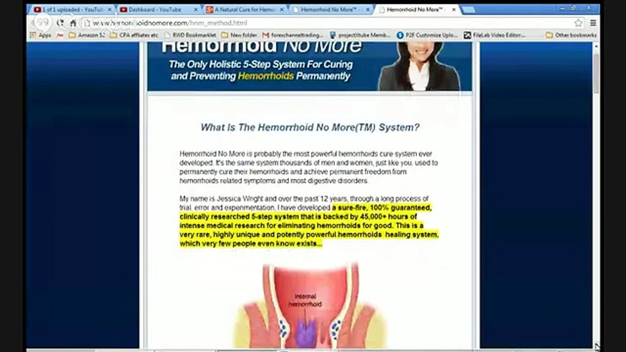 A Natural Cure for Hemorrhoids - Review of "Hemorrhoid No More" System