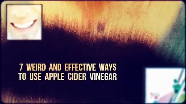 Benefits of Apple Cider Vinegar tablets | Apple Cider Vinegar Benefits | Top 7 BEST Benefits of ACV