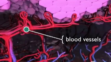 What is Rosacea Laser Treatment?