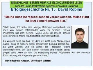 haut akne - akne narben loswerden - nie mehr akne buch download