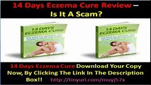 14 Days Eczema Cure Review - Does It Really Works Or Is It A Bunch Of Scam?