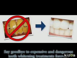 Kizoa - Video Maker: Teeth Whitening 4 You
