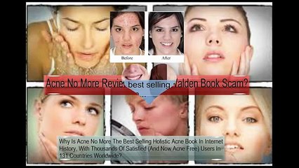 Acne No More Reviews - Is Mike Walden Book Scam?