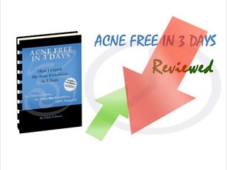 Chris Gibson Acne Free in 3 Days: Acne Free in 3 Days Review - Part 1