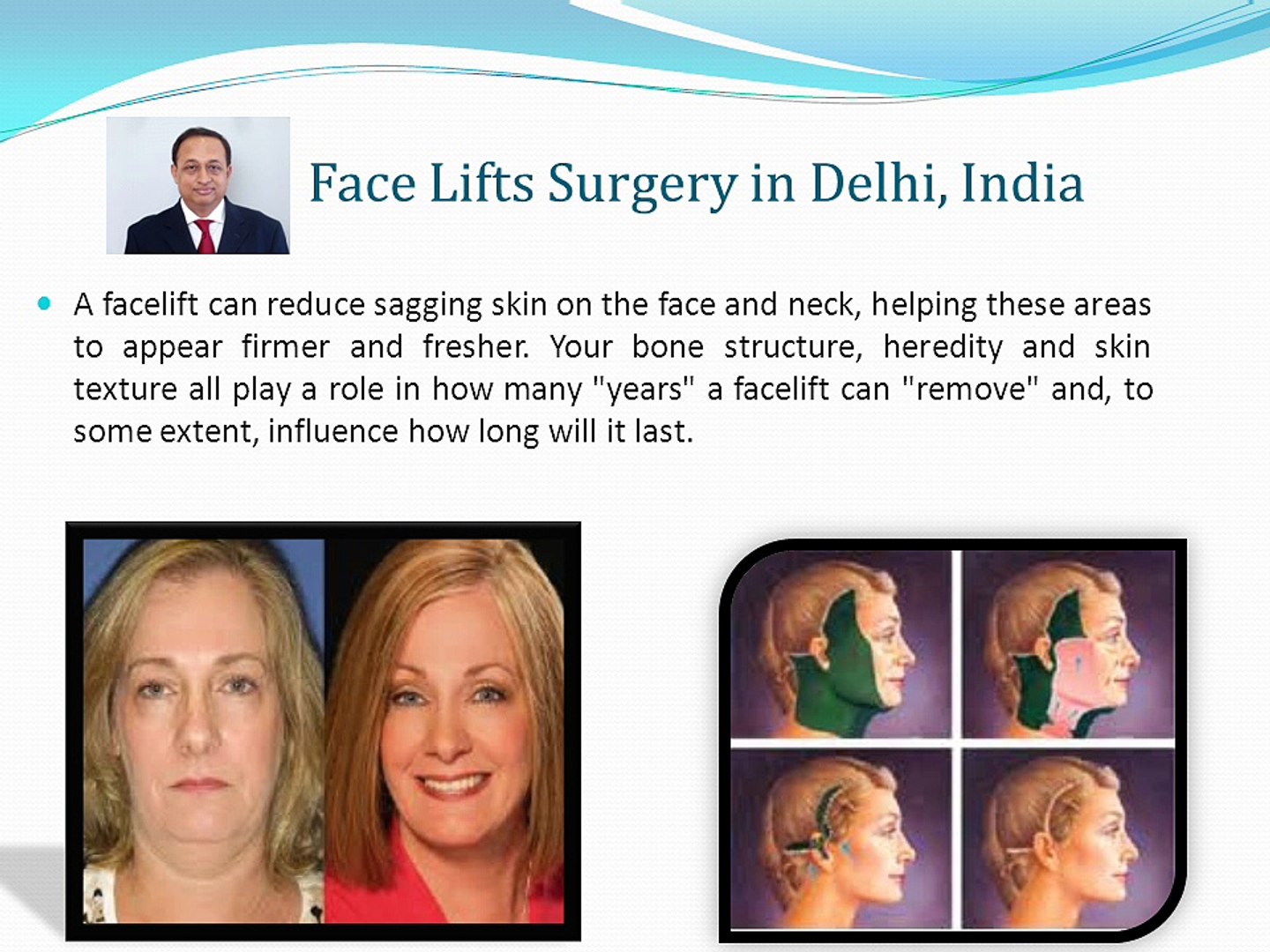 Plastic Surgery in Delhi India