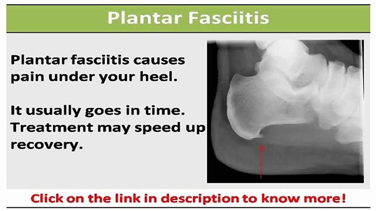 See now   new balance running shoes plantar fasciitis