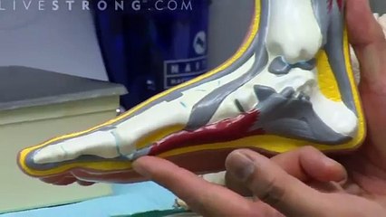 Plantar Fasciitis Health Byte