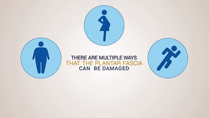 What is Plantar Fasciitis?