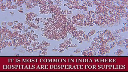 The Cost Of Your Body Parts On The Black Market