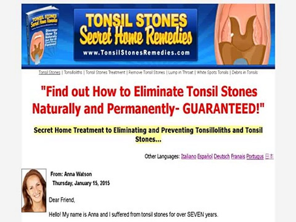 Tonsil Stones Secret Home Remedies