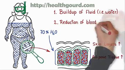 Cellulite Factor Review | Cellulite Reduction Treatment That Works