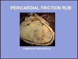 Heart Sounds - Pericardial Rub and Innocent Systolic Murmur (480p)