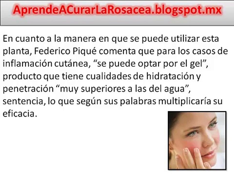 Aloe Vera Para La Rosacea / La Solución