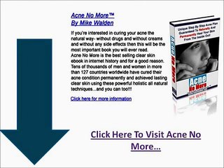 Acne No More - External Acne Care: The Pros and Cons of Washing Your Face